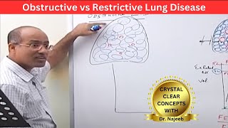 Obstructive vs Restrictive Lung Disease  Pulmonary Function Test🫁 [upl. by Mccahill]