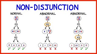 MEIOSIS NON DISJUNCTION AND DOWN SYNDROME GRADE 12 LIFE SCIENCES THUNDEREDUC MSAIDI [upl. by Leizar]