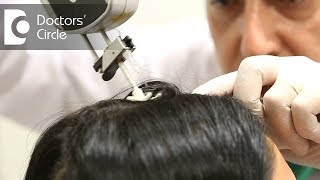 What is the role of Mesotherapy in hair loss  Dr K Prapanna Arya [upl. by Einttirb]