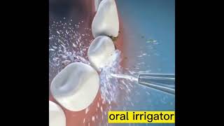 Irrigador Oral Dental Bucal Jato De Água Sem Fio [upl. by Terrilyn]