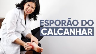 ESPORÃƒO NO CALCANHAR O que fazer [upl. by Mmada]