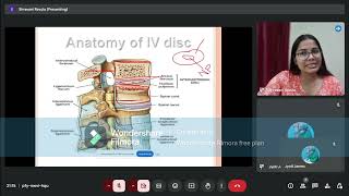 Prolapsed Intervertebral Disc Anatomy of IV Disc [upl. by Cindra]