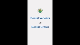 Front Teeth Crowns vs Veneers Simplified [upl. by Giana]