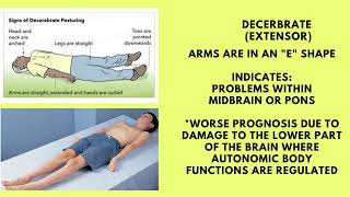 TBI Posturing Decerebrate vs Decorticate [upl. by Barcroft]