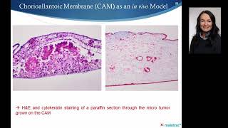 Circulating tumor stem cells by stemtrac® to assess tumor aggressiveness and risk of metastasis [upl. by Wedurn610]