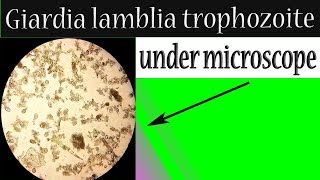 Giardia lamblia trophozoite under microscope In stool sample [upl. by Atnek709]