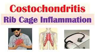 Costochondritis Rib Cage Inflammation  Causes Symptoms Diagnosis Treatment [upl. by Luce89]