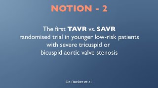 Shortterm data from NOTION2 TAVR vs SAVI for younger patients with aortic stenosis  EuroPCR 2024 [upl. by Sinnelg]