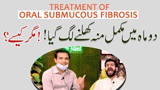 Complete MOUTH OPENING achieved in TWO months  Oral Submucous Fibrosis  InqalabFareed [upl. by Yordan385]