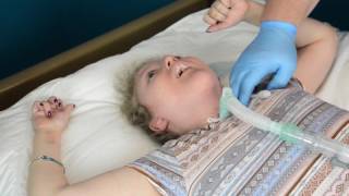 Routine Trach Tube Change [upl. by Hendrick]