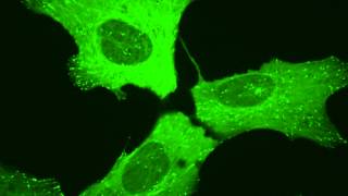 Microtubule dynamics in a living human cell [upl. by Urd335]