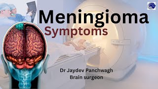 Meningioma The Brain Tumor You Might Have And Not Even Know It [upl. by Ecirum]