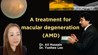 A Treatment for Macular Degeneration AMD What Every Patient Should Know About Bruchs Membrane [upl. by Senecal]