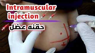 تعلم اعطاء الحقن العضل بدون اخطاءLearn to give intramuscular injections without mistakes [upl. by Ardnekahs167]