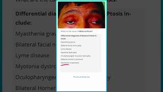 Causes of Bilateral Ptosis [upl. by Conway]