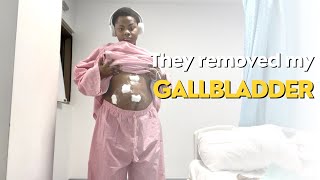 MY LAPAROSCOPIC GALLBLADDER REMOVAL SURGERY  RECOVERY [upl. by Redep661]