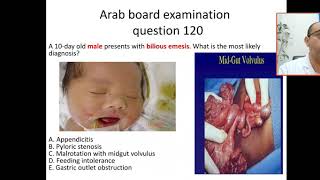 case 120 How to approach for vomiting in newborn bilious emesis is malrotation volvuluspyloric [upl. by Dierolf]