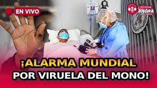 😱 ¿Nueva pandemia Viruela del mono 😷 fue declarada nueva emergencia de salud pública internacional [upl. by Arateehc]