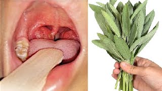 Cuts Cough Like a Knife 💯 Expectorant 😷 Natural Antibiotic for Bronchitis and Pharyngitis ❗ Liver [upl. by Landy]