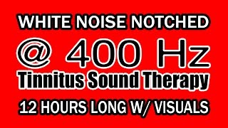 White Noise  Notch Filtered at 400 Hz for Tinnitus Therapy w Visuals [upl. by Marieann474]