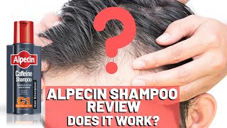 Alpecin Shampoo Review  Do We Recommend It [upl. by Eidnil327]