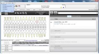 CS R4 2 Minute Training Printing a treatment plan [upl. by Eiaj]