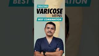 The Easiest Way to Say Goodbye to Varicose Veins [upl. by Mungovan]