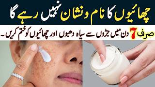 صرف 7 دنوں میں جھائیوں سے نجات پائیں I Reduce Melasma I Pigmentation I Discolouration I Blackspots [upl. by Girand]