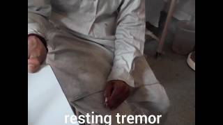 Resting tremor of Parkinsons disease [upl. by Ennayelsel627]