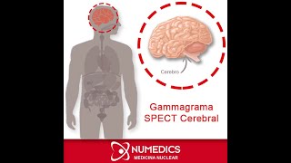 Gammagrama SPECT Cerebral [upl. by Snowman]