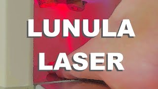 Lunula Laser  Fungal Infection Removal With Lasers [upl. by Alehcim]