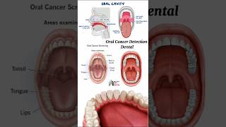 Oral Cancer Detection  Dental medical animation 3d short [upl. by Lyell]