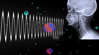 How Do Xrays Work [upl. by Mongeau]