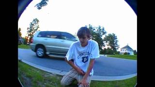 russell breaks arm skateboarding [upl. by Gilly]