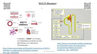 Herzinsuffizienz Therapie 6 SGLT2 Hemmer und Vericiguat [upl. by Aioj]