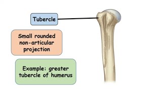 Tubercle Bone Marking [upl. by Eisaj690]