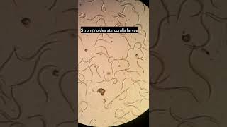 Strongyloides stercoralis larvae Strongyloidiasis parasiteParasite under microscope microscopy [upl. by Brookes]