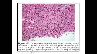 Pediatric Hepatology Cases  Discussion [upl. by Anastice326]