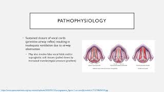 Common Perioperative Complications Keyword Review  Dr Green [upl. by Ntisuj]