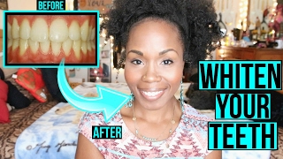 How to Whiten Teeth FAST amp NATURALLY  SIMPLE Cleaning amp Teeth Brushing Routine [upl. by Kirch]