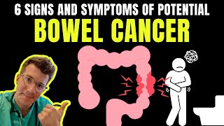 6 SIGNS AND SYMPTOMS OF BOWEL CANCER [upl. by Rudelson124]