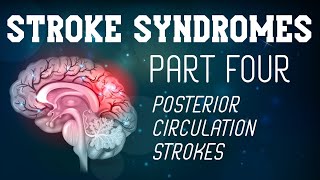 Stroke Syndromes Part 4 of 4  Posterior Circulation Strokes [upl. by Nednal966]