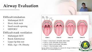 Introduction to Anesthesiology [upl. by Ferri296]