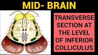 MidBrain Anatomy 23  TS at level of Inferior Colliculus [upl. by Olivette]