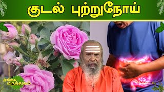 குடல் புற்றுநோய்  Mooligai Maruthuvam  Vendhar TV [upl. by Auhoj863]