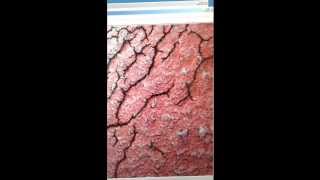 Fibrin formation [upl. by Doll599]