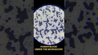 Human blood under the microscope Blood cells Hematology shortvideo [upl. by Alberta]