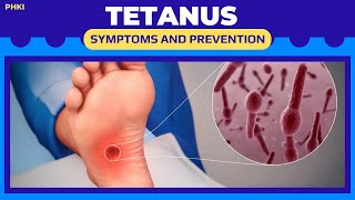 TETANUS causes symptoms and prevention [upl. by Ellerey686]