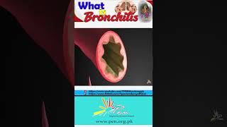 What is Bronchitis I Causes Of Bronchitis I Gaseous Exchange I Biology [upl. by Rifkin306]