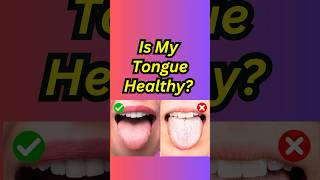 Is My Tongue Healthy How to Nourish It tonguehealth healthytongue oralhealth shorts [upl. by Atsejam]